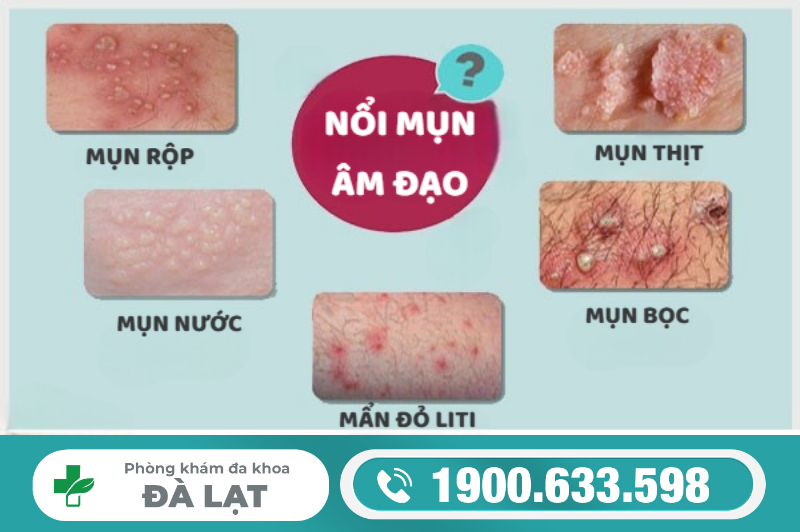 Hình ảnh minh họa